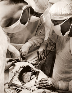 Lung Regional Incision Surgery #1 [Sojiro Mori,  from Camera Mainichi October 1955] Thumbnail Images